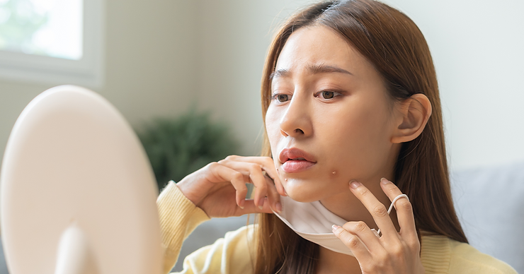 Clear Acne-Free Skin Can Be Yours